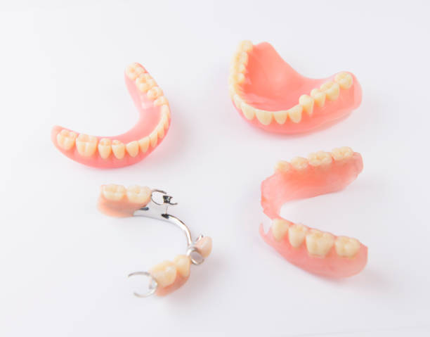 Group of dentures on white background.