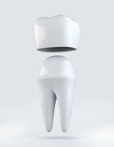 3D illustration of Crown tooth on white, dental concept.