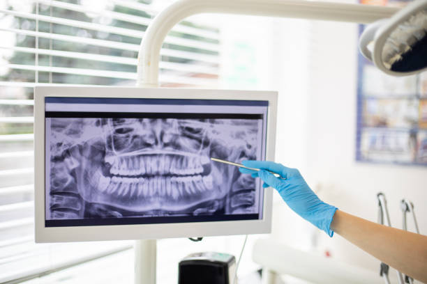 Dental radiogram on screen
